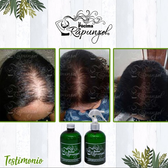 Shampoo - Picture 7 of 7